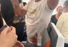 Пилот Flydubai мог погибнуть после нападения на борту самолета